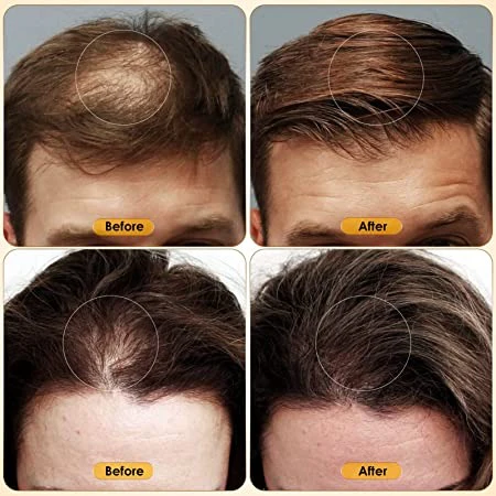 Healthy hair